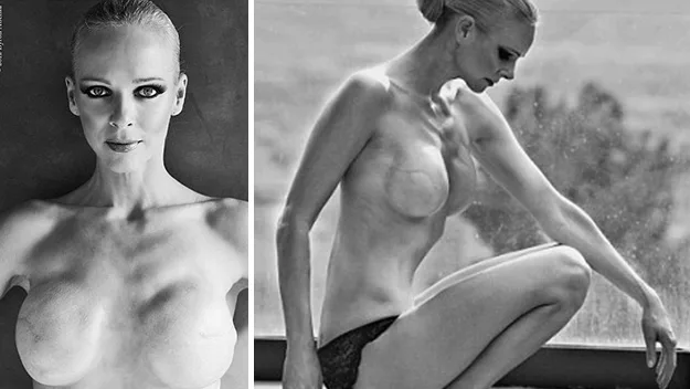 Model Claire Farwell's post-double-mastectomy photoshoot