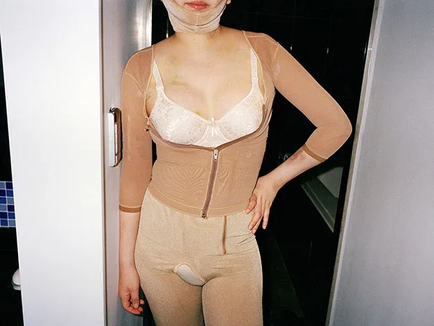 Woman in beige compression garment with facial bandage standing in a doorway.