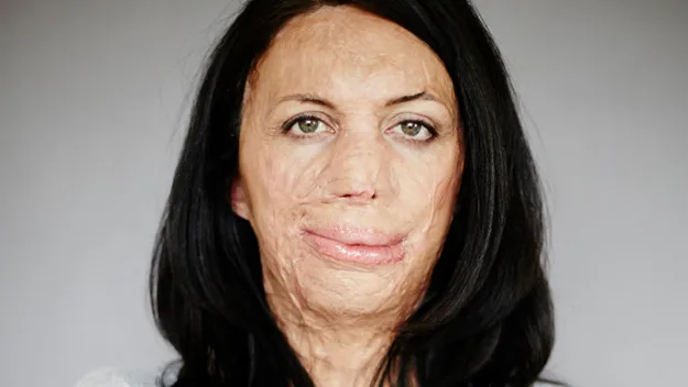 Portrait of a woman with long dark hair, with facial scars and a composed expression against a neutral background.