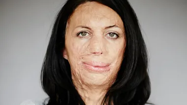 Portrait of a woman with long dark hair, with facial scars and a composed expression against a neutral background.