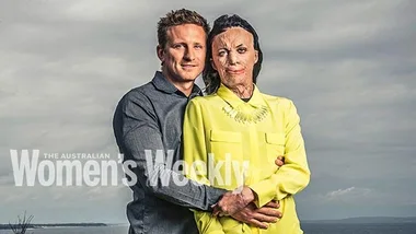 Turia Pitt and her partner Michael Hoskins