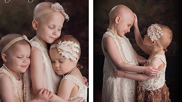 three little girls battling cancer in remission