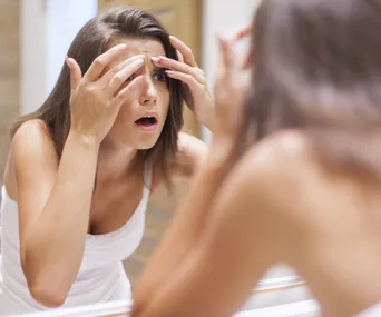 adult acne, thinkstock