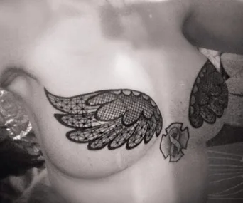 A woman with mastectomy scars has intricate wing tattoos across her chest, symbolizing strength and transformation.