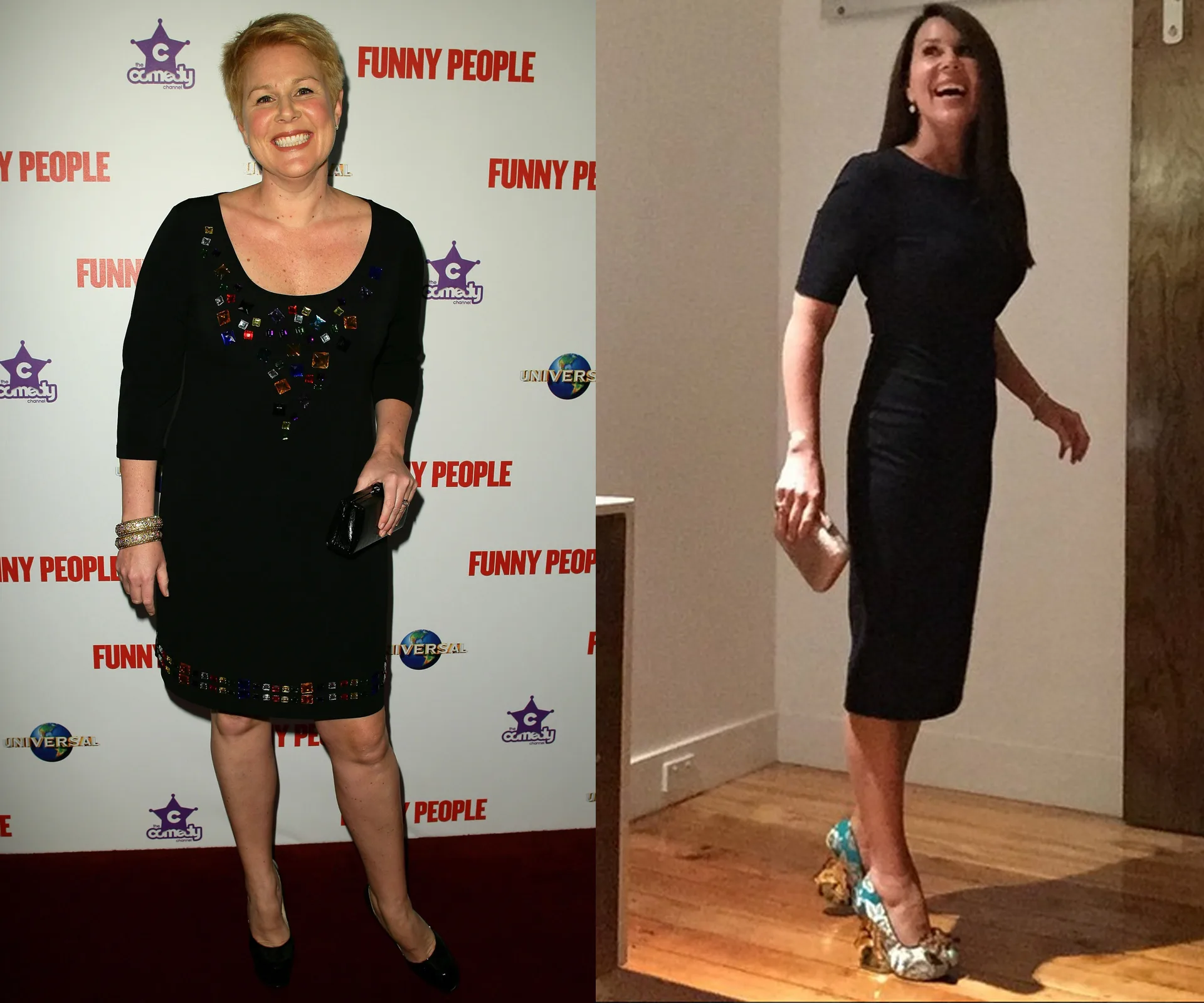 Side-by-side comparison of a woman in two different black dresses, showcasing weight loss transformation.