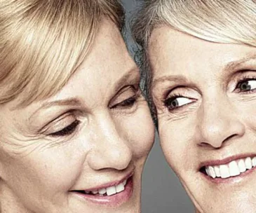 Two older women with wrinkles smiling at each other, showcasing natural facial expressions and aging.