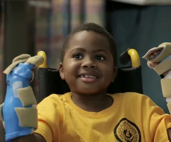 Young boy smiles in a wheelchair, wearing protective hand coverings after double hand transplant surgery.