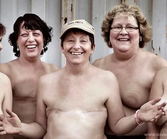 Women smiling confidently, standing together, showing scars with a supportive and positive attitude.