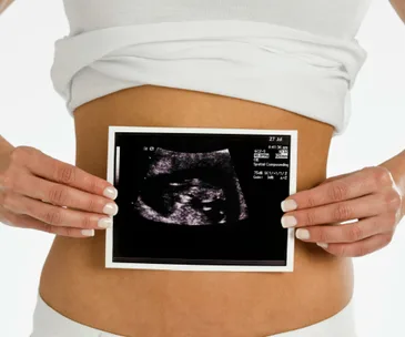 A woman holding an ultrasound image against her bare stomach, showing a developing fetus.