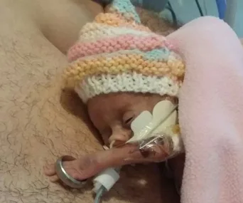 Premature baby with knitted hat holds parent's wedding ring on tiny arm.