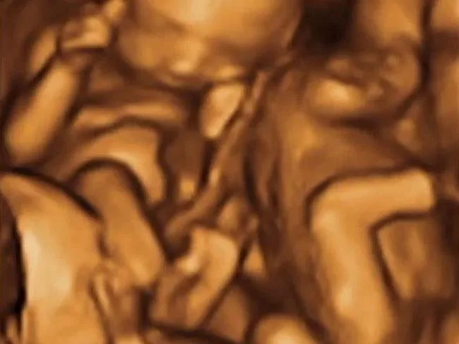 Fake ultrasound image from fakeababy.com