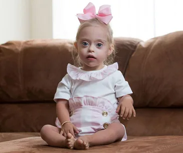 Toddler with Down syndrome nabs modelling contract