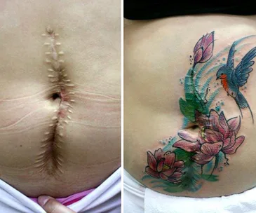 Artist offers free tattoos for survivors of domestic violence