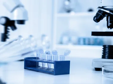 A laboratory setting with test tubes in a rack and microscopes in the background.