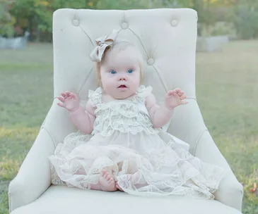 The beautiful faces of Down syndrome