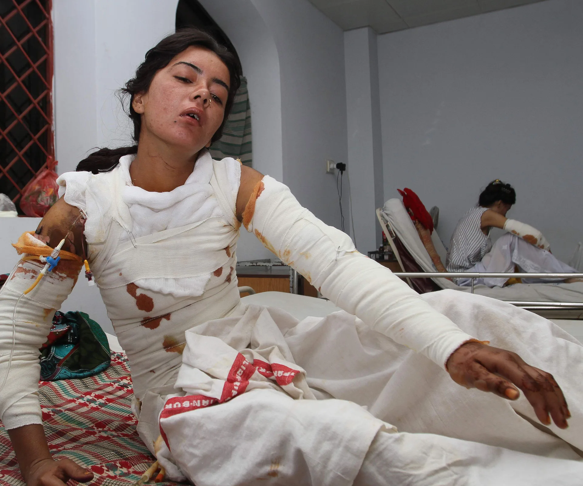 A woman with bandaged arms and neck is sitting on a hospital bed in a clinical setting.