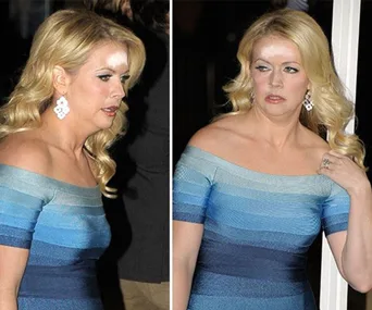 A woman in an off-shoulder blue dress with uneven makeup on her forehead, looking sideways.