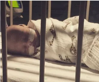 Baby wrapped in printed blanket, with medical tube, sleeping in hospital crib behind bars.