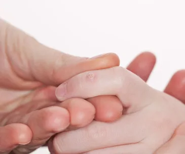 Close-up of fingers with a wart on one finger being gently held by another hand.
