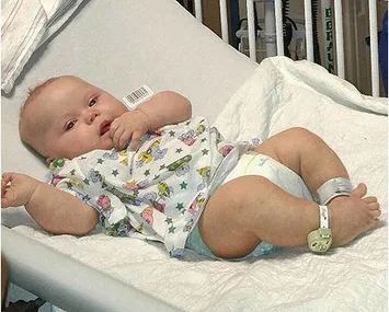 A baby wearing a patterned shirt and diaper is lying on a hospital bed, looking at the camera with medical tags on.