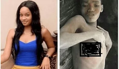 Left: Woman in a blue top and yellow skirt smiling. Right: Person lying in a pit, appearing malnourished and distressed.