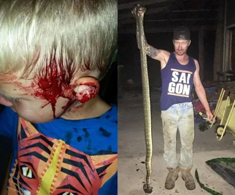 A young boy with a bleeding head wound and a man holding a large snake upright in a garage setting.