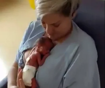 Mum cradles her premature baby on her chest, sharing a tender and loving moment in the hospital.