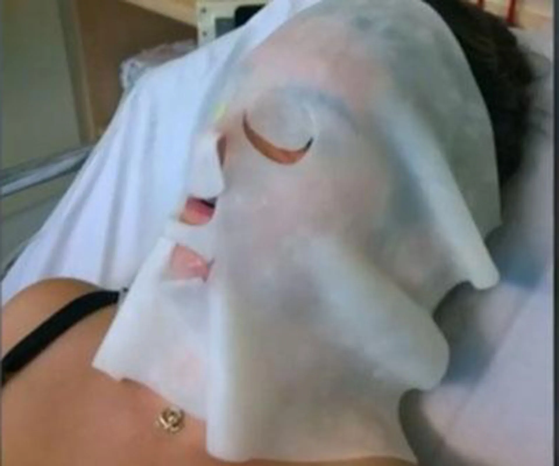 A person lying down with a protective face mask, recovering in a medical setting.