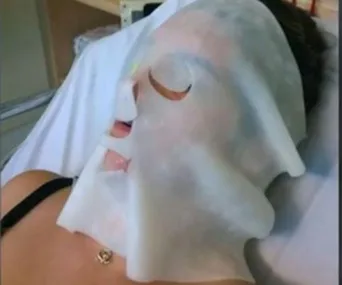 A person lying down with a protective face mask, recovering in a medical setting.