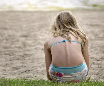 A young girl sits on grass in a swimsuit, facing the beach, with visible spine outlining concerns related to anorexia.