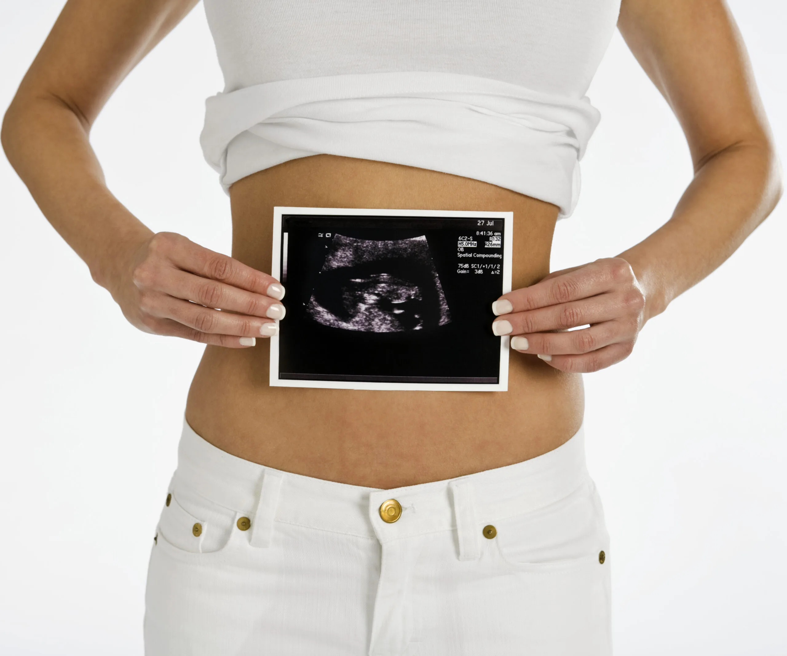 woman holding sonogram
