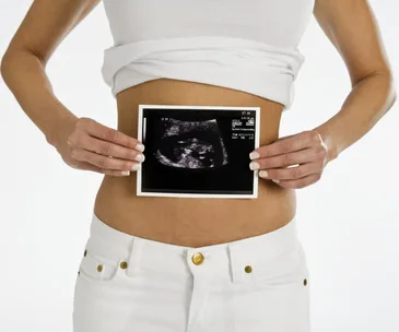 woman holding sonogram 
