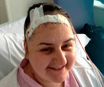 Smiling woman in hospital bed with a bandaged head, recovering from brain surgery.