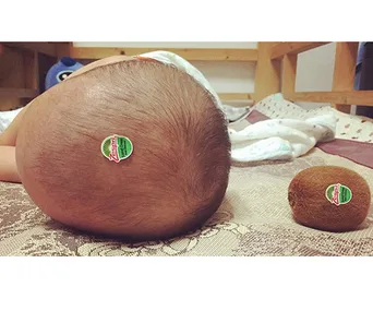 Baby's head with a kiwi sticker next to an actual kiwi fruit, both lying on a patterned surface.
