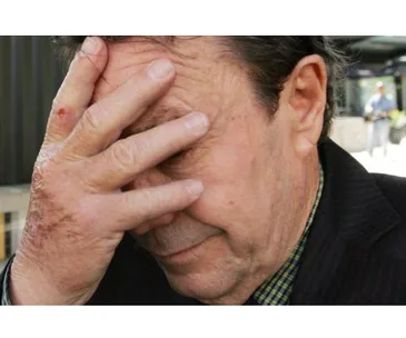 Older man in a suit covers his face with one hand outdoors, displaying a gesture of frustration or disbelief.