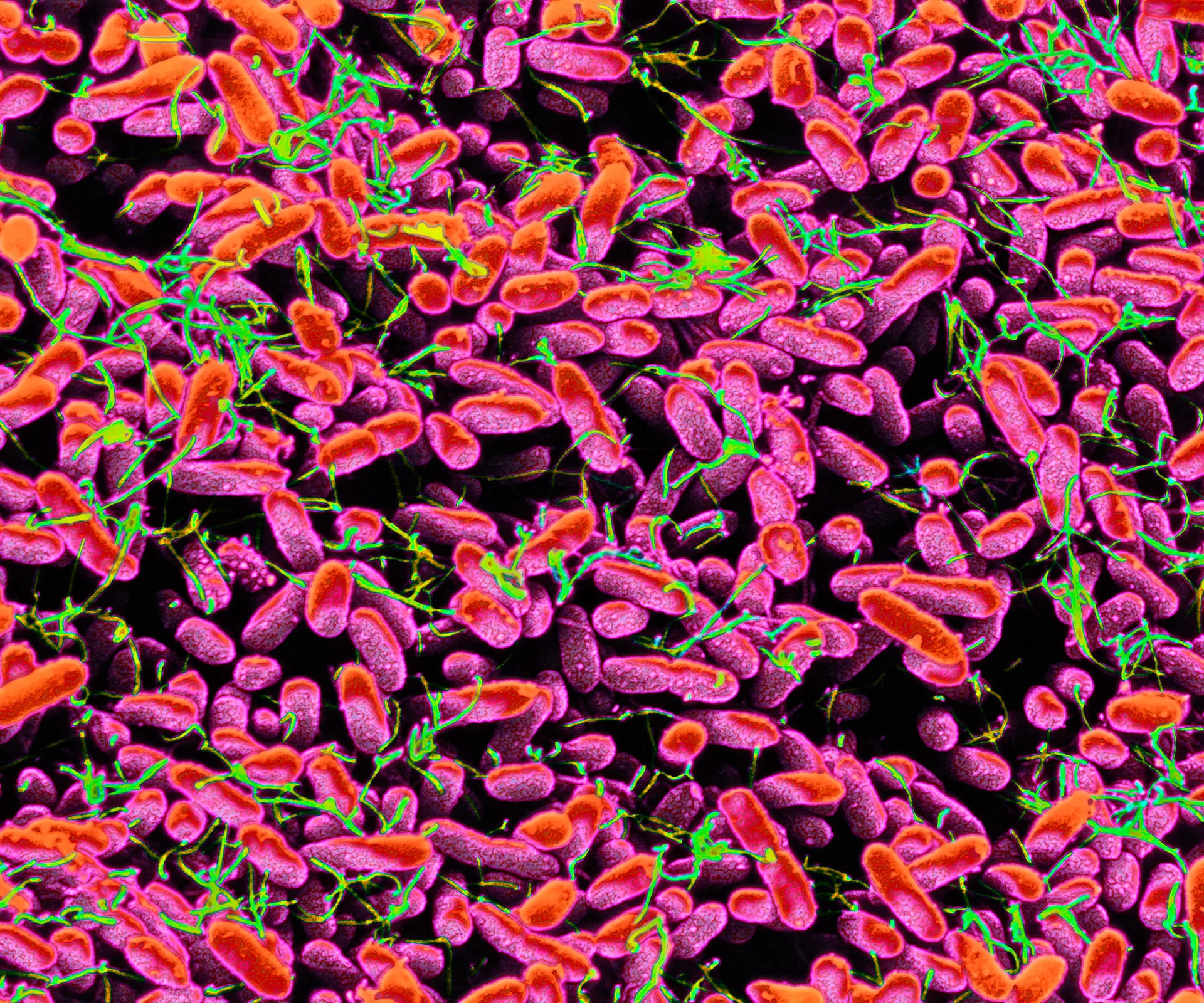 Colorized electron micrograph showing Salmonella bacteria with bright pink and orange rod shapes and green flagella.