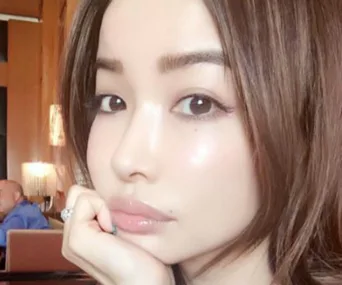 Young woman with flawless skin, wearing a diamond ring, resting her chin on her hand in a stylish indoor setting.