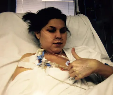 A person in a hospital bed gives a thumbs-up, with medical tubes and equipment attached.