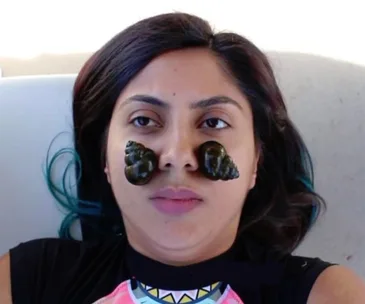 Snail facial.