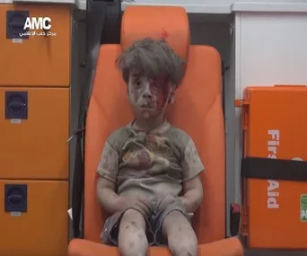 A young, dust-covered boy with a blood-stained face sits in an orange ambulance seat, looking disoriented.