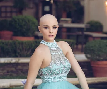 A bald woman in a detailed turquoise dress poses confidently outdoors.