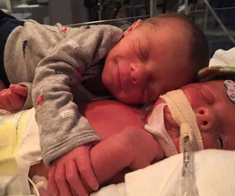 Twin babies cuddling; one sleeping peacefully on the other, who is intubated and receiving medical care.