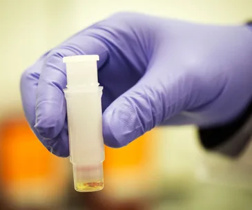 Gloved hand holding a small vial containing a sample for research related to Crohn's disease.