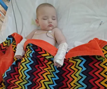 A sleeping baby in a hospital bed with colorful zigzag blanket and bandaged hands.