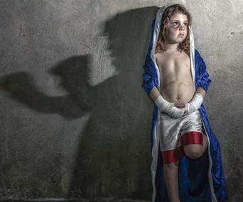 Child in boxing attire with a surgery scar, casting a strong shadow on the wall resembling a fighter stance.