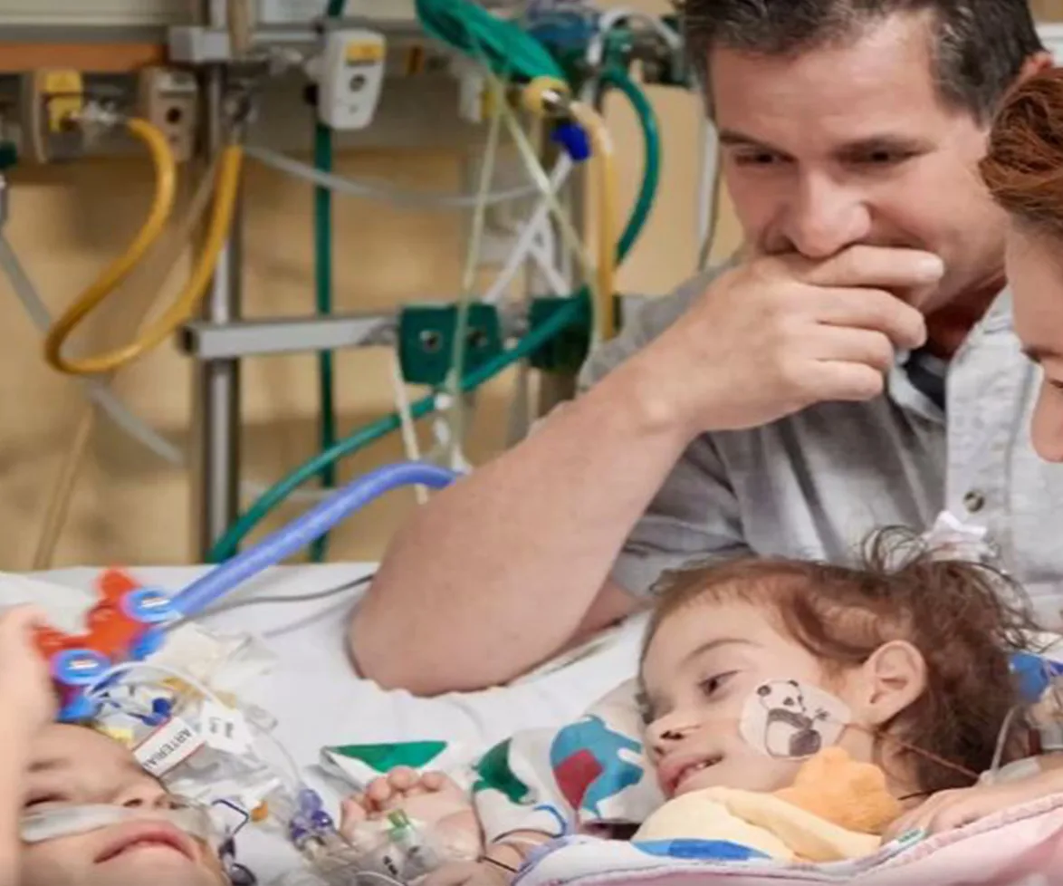 Conjoined twins separated and their doting parents