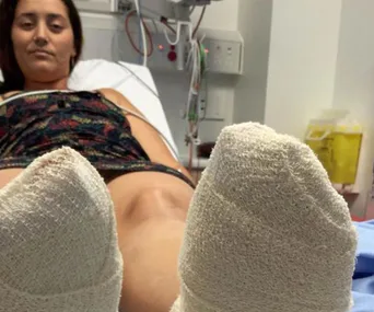 Woman in hospital bed with both feet heavily bandaged after severe burns from hot sand at a beach.