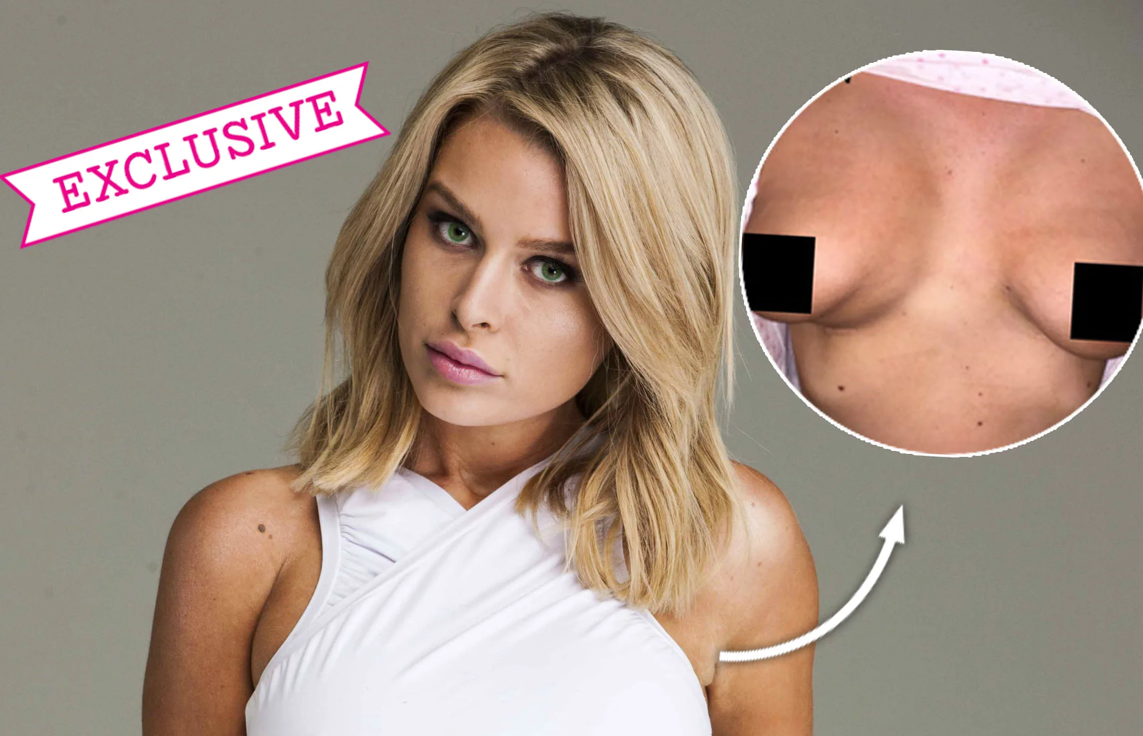 Woman in white top beside inset image showing botched surgery with "Exclusive" label.