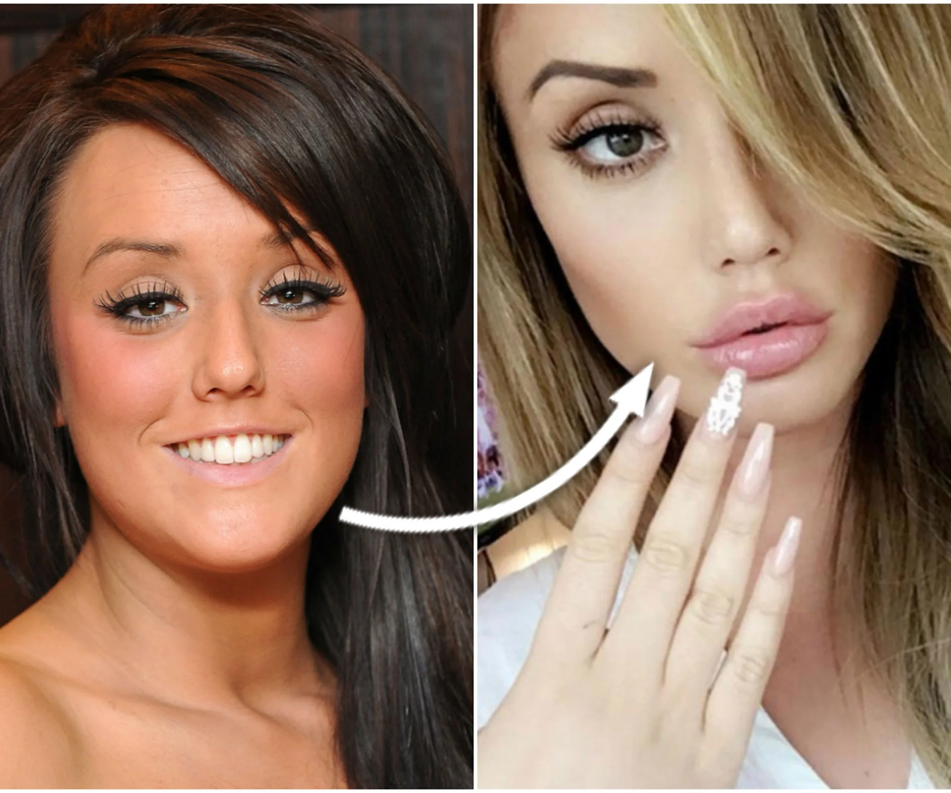 charlotte crosby, surgery