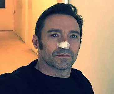Hugh Jackman